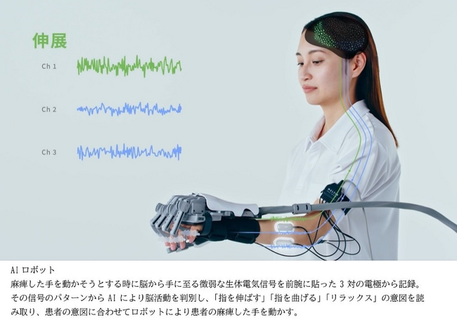 麻痺した手を思い通りに動かすＡＩロボット