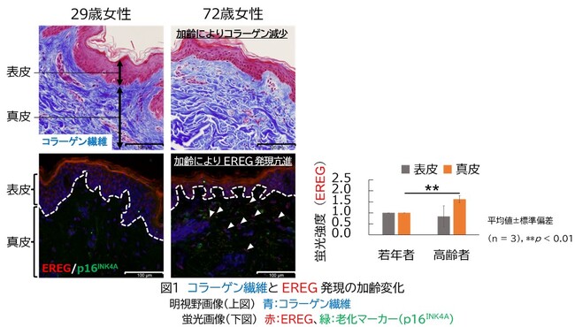 シワやたるみといった加齢による老化現象を促進させる新たな因子を発見