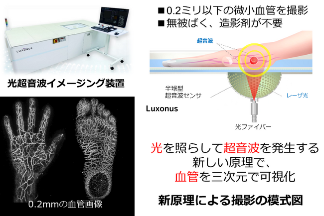 光超音波画像診断装置を開発する株式会社Luxonus「第６回日本医療研究開発大賞『スタートアップ奨励賞』」を受賞
