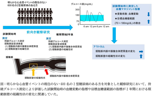 持続グルコース測定の血糖マネジメント指標と動脈硬化の関連性が明らかに