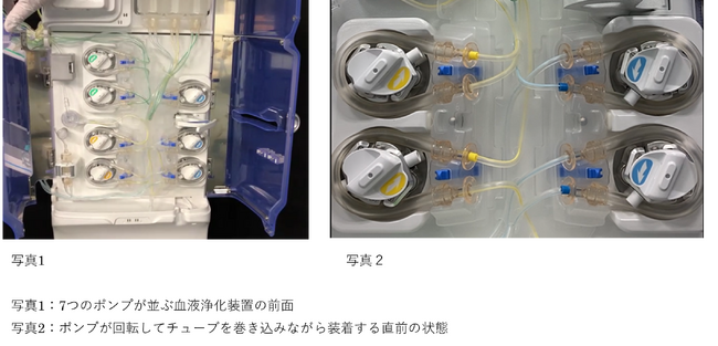 日機装、中部地方発明表彰「金沢市長賞」を受賞 血液浄化装置の準備で時短、治療をより迅速・確実に