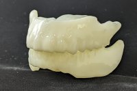 インフルエンザの季節、ドライマウスで感染のリスクも上がる！歯がないと口が渇きやすく寝る時専用入れ歯の製作数が3倍に増加！