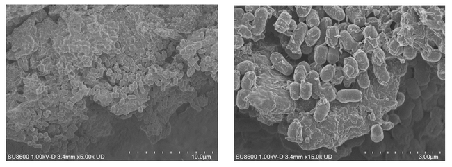 角栓内アクネ菌について独自の殺菌評価方法を確立　～ニキビができやすい人の角栓内にはアクネ菌が多く存在～