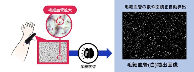 1000本以上の皮膚毛細血管を一度に可視化し定量化する新技術