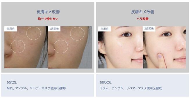 シンビジャパンより先行販売！４0年の研究200億ウォンの投資で完成した肌成長因子EGF専門ブランド「EGFOLOGY」2023年12月14日から19日まで予約販売開始