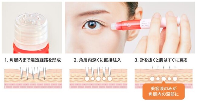 発売3カ月で年度販売目標数※1を達成!「CONC リンクル インジェクション」が好調