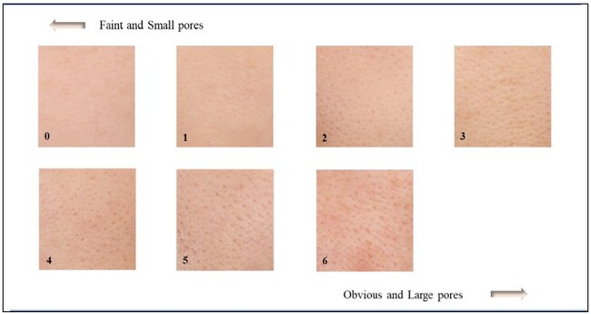 高濃度ビタミンC誘導体とノイバラ果実エキスの併用によるヒトの肌への効果をハーバー研究所が検証