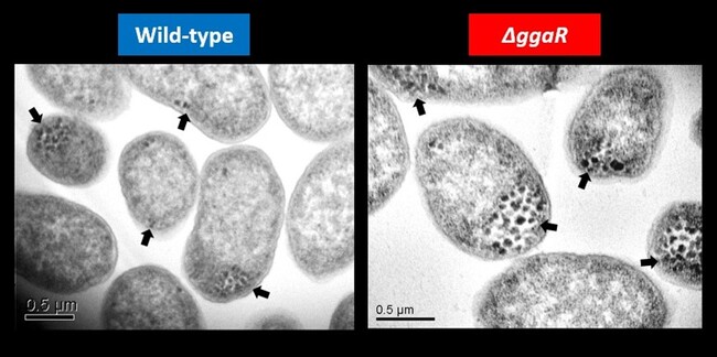 腸内細菌のグリコーゲン蓄積を制御する新規転写因子を同定　～微生物の炭素源代謝の理解や物質生産への応用に期待～