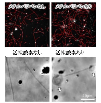 【ファンケル研究情報】ヒトｉＰＳ細胞由来の感覚神経でヒリヒリやかゆみなどの感覚を評価する方法を開発