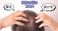 20代以上の女性の頭皮悩みは「抜け毛」がトップ！印象に影響を与えるヘアスタイルと、頭皮についての意識を年代別に分析した結果が明らかに
