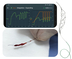 ラピッド・メディカル™が世界初のロボット血栓除去装置で虚血性脳卒中手技を成功裏に完了