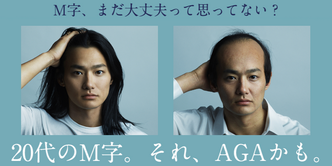 40代の薄毛になった野村周平がタイムトラベル！20代の額の『M字』に薄毛宣告