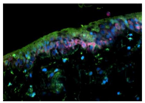 摘出皮膚※1の長期培養技術と立体的かつ動的な変化の観察（4Dイメージング）に成功