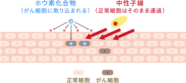株式会社CICS（リゾートトラスト株式会社の連結子会社） BNCTの特定臨床研究に関する契約を江戸川病院と締結　～FDG-PET陽性の浅在性腫瘍に対する研究にBNCT用装置に関する技術を提供～