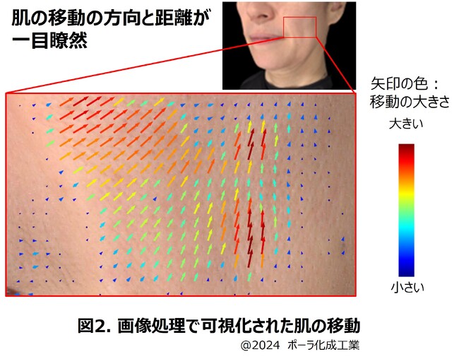 リフトアップ印象のカギは上向きではなく「斜め外向き」の肌の移動