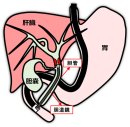 経口胆道鏡のイメージ図