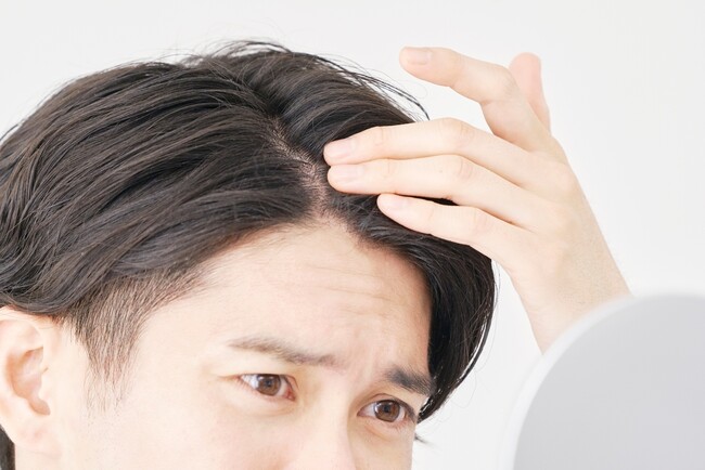 ■男性８割が抱える「頭髪・頭皮の悩み」／６割以上が頭髪ケアを実施、その理由トップ３【１.身だしなみ ２.薄毛予防 ３.頭皮の健康維持】 　～ 20～60代男性941名へ「夏の頭髪・頭皮ケア」を調査 ～