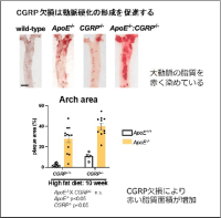 【岡山理科大学】神経ペプチドCGRP抑制は動脈硬化マウスの症状を悪化させる