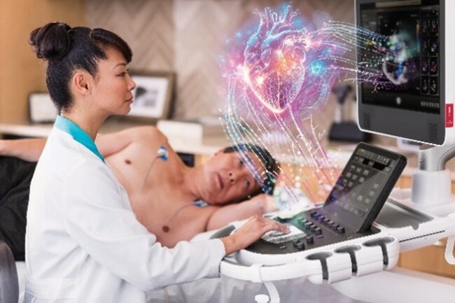 AIを強化した循環器向け超音波画像診断装置Transcendシリーズと細径3D 経食道トランスジューサX11-4t 販売開始