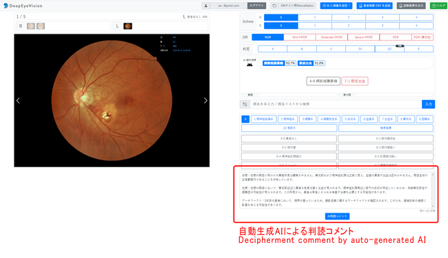 自治医科大学とDeepEyeVision、LMM（大規模マルチモーダルモデル）による眼底読影所見の自動生成機能を構築