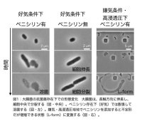 大腸菌L-formにおいて、隔壁合成はアメーバ様細胞から一定の大きさの球形細胞への変化に必要である〜進化の過程で細胞形態がどのように決められたかの考察〜