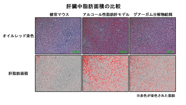 【摂南大学】水溶性食物繊維 ”グアーガム分解物” のアルコール性脂肪肝の改善効果を解明