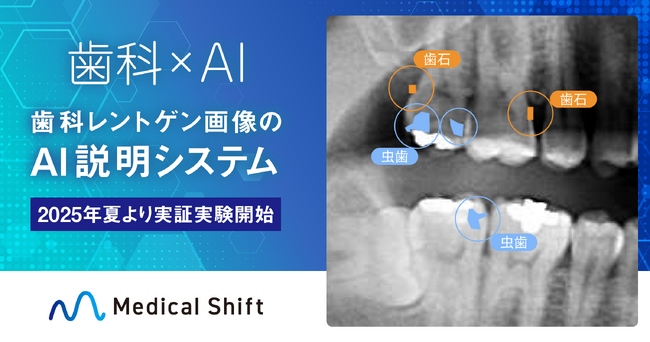 Medical Shift、「歯科レントゲン画像のAI説明システム」を開発し、2025年夏より実証実験開始