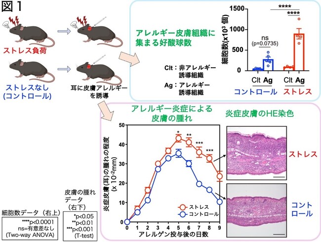 精神的ストレスがアトピー性皮膚炎を悪化させるメカニズムを解明