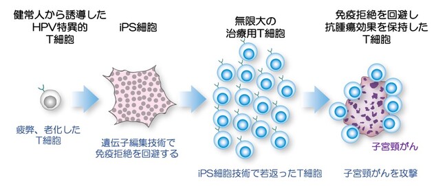 順天堂大学発「子宮頸がんに対するiPS細胞由来CTL療法の医師主導治験」開始のお知らせ