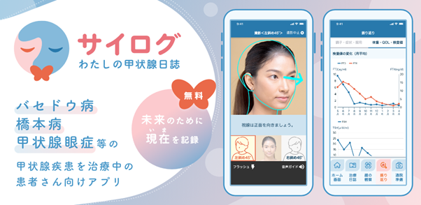 アムジェン、甲状腺疾患患者向けアプリ「サイログ」提供開始のお知らせ