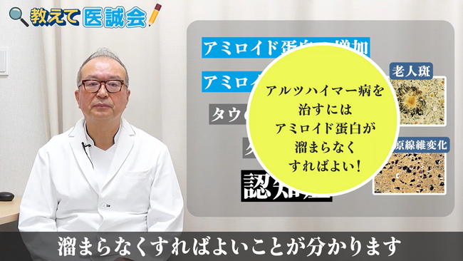 認知症専門医による新しい治療薬の解説動画を投稿/教えて医誠会