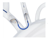 経カテーテル的大動脈弁留置術（TAVI）向け脳塞栓保護デバイス「SENTINEL™ Cerebral  Protection System」日本初登場