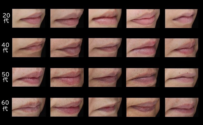 唇の加齢印象、「ふくらみ指数」で把握する方法を確立