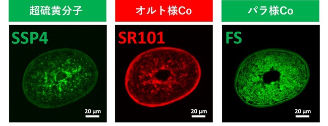 新たな結合『超硫黄分子』、コルテックスとメデュラでの存在を確認