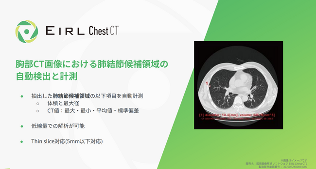 胸部CT画像から「肺がん」が疑われる肺結節候補域の検出を支援するEIRLChest CT、薬事承認を取得し販売開始