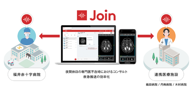 福井県初!Joinによる急性期医療連携を開始