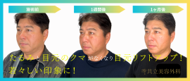 真中満氏クマ取り治療 真中満氏クマ取り治療