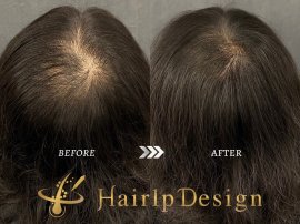 ビフォーアフター