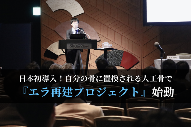 【日本初導入】自分の骨に置換される人工骨で『エラ再建プロジェクト』始動！救済措置として2025年5月8日(木)モニター募集開始