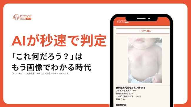“これ何だろう？”は、もう画像でわかる時代。AIが秒速で判定。