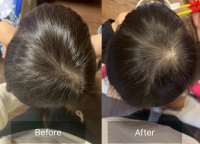 赤ちゃんの頭をまん丸に！AGOセラピストスクールが100名限定で頭の形ケアモニターを募集　沖縄県那覇市で7月22日に開催