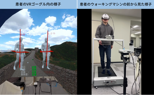 ギャラクシーズ、姿勢分析VR投影システムを開発・AIを活用し歩行指導VRとして応用、病院との共同プロジェクトを開始