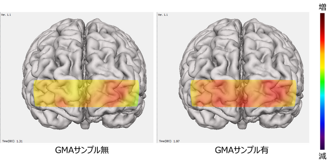 緊張汗でストレスや不安が生じても、汗対策を行うことで、仕事の生産性・パフォーマンスが向上