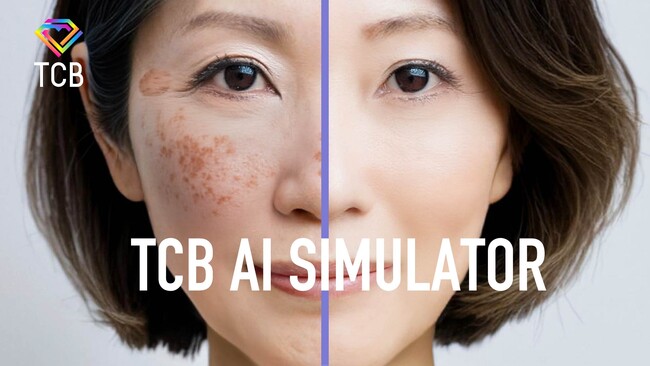 TCB東京中央美容外科の新テレビCM「TCB AIエイジングケア シミ取り」篇 　6月11日(水）より全国でオンエア開始
