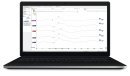 皮質聴覚誘発電位検査画面