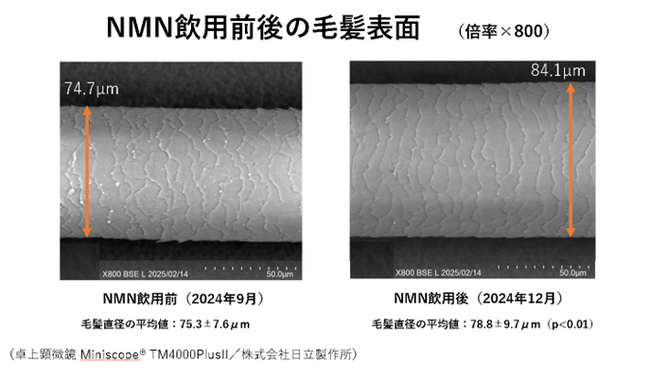 NMNの毛髪への影響に関する最新試験結果を発表