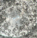 ヒト膵がん患者由来オルガノイドの増殖試験(8日後)　a) InnoCell(R) プレート Nタイプ／地方独立行政法人大阪府立病院機構大阪国際がんセンター 平塚 徹 チームリーダー ご提供