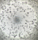 ヒト膵がん患者由来オルガノイドの増殖試験(8日後)　b) 既存ポリスチレン製プレート／地方独立行政法人大阪府立病院機構大阪国際がんセンター 平塚 徹 チームリーダー ご提供