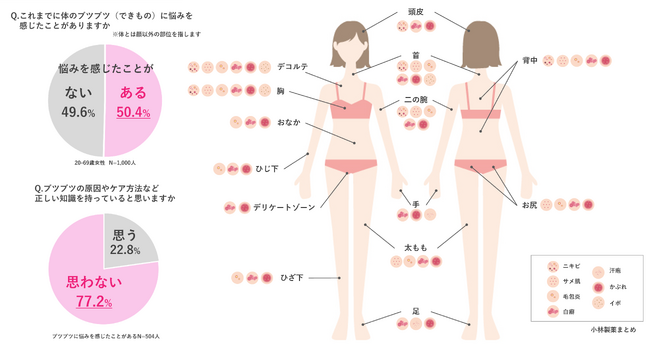 それってニキビじゃないかも？“ からだの部位 ”や“ ブツブツの種類 ”ごとに正しいケアへと導く、皮膚科医監修「からだのブツブツまるわかりMAP」を公開！