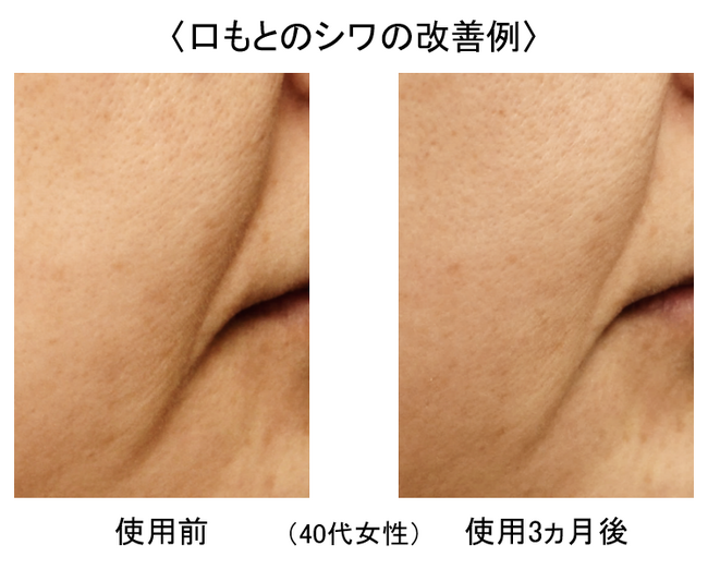 霊芝の亜臨界水抽出物が肌のDNA修復能力を高め、様々な肌悩みを改善することを発見